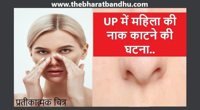 Women's Nose Chopped Off: UP में महिला की नाक काटने की घटना ने सबको किया हैरान जानिए पूरा मामला 13 Women’s Nose Chopped Off: UP में महिला की नाक काटने की घटना ने सबको किया हैरान जानिए पूरा मामला
